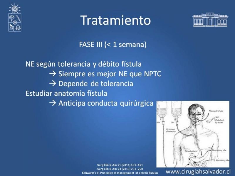 Diapositiva 13 de Fístulas Intestinales