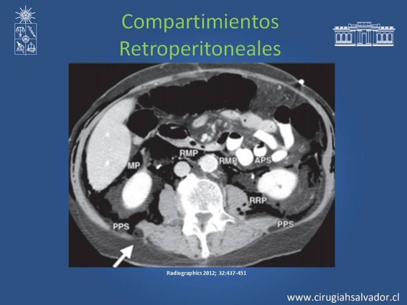 Diapositiva 38 de Anatomía Peritoneal y Retroperitoneal