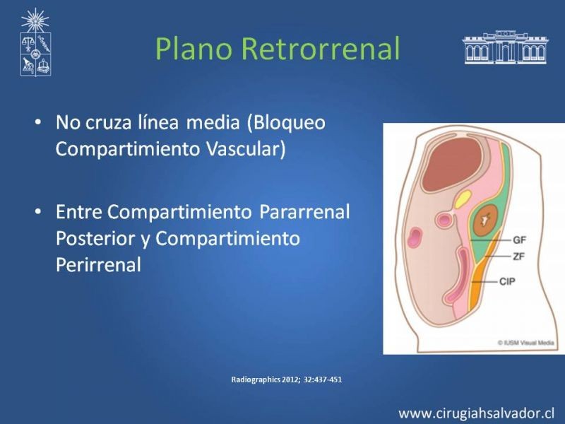 Diapositiva 46 de Anatomía Peritoneal y Retroperitoneal