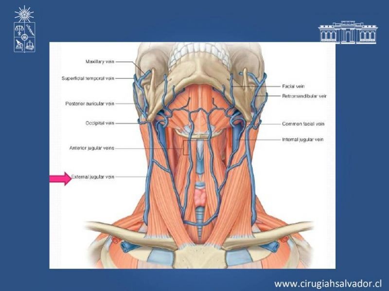 Diapositiva 8 de Traqueostomía