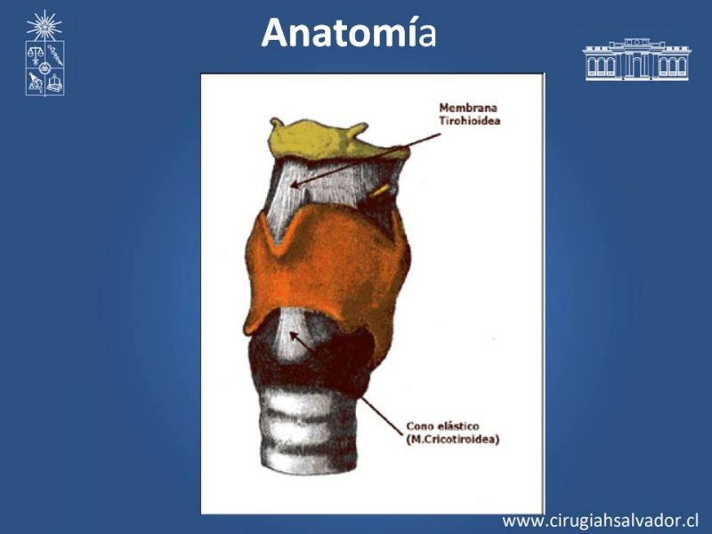Diapositiva 7 de Traqueostomía