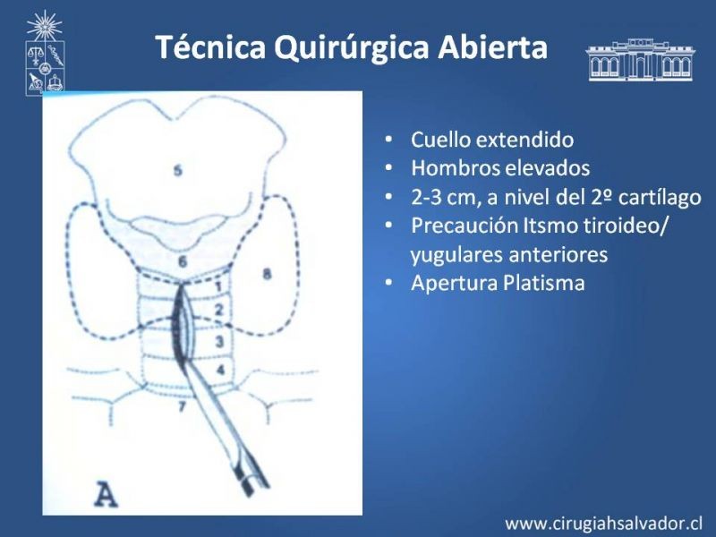 Diapositiva 9 de Traqueostomía