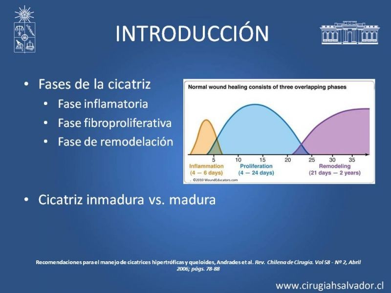 Diapositiva 3 de Cicatrices patológicas