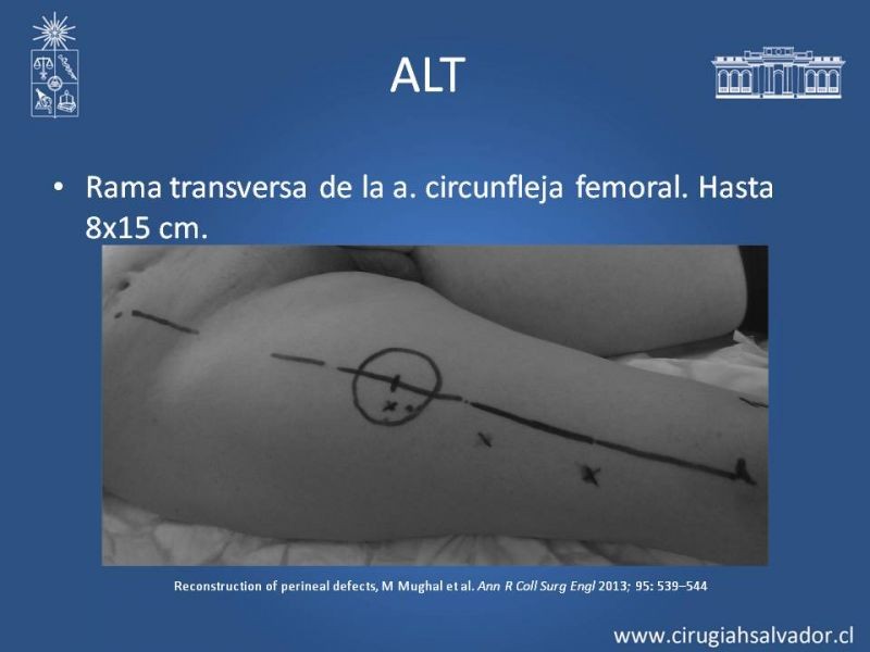 Diapositiva 32 de Reconstrucción Perinea