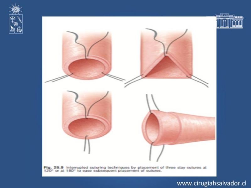Diapositiva 15 de Principios Básicos de Microcirugía