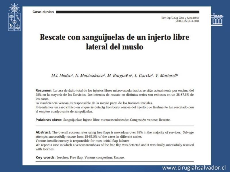 Diapositiva 33 de Principios Básicos de Microcirugía