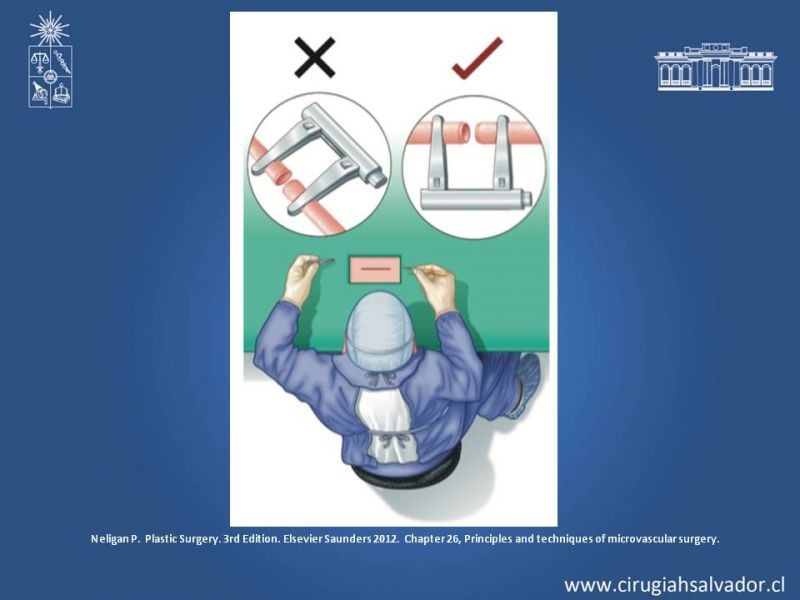 Diapositiva 12 de Principios Básicos de Microcirugía