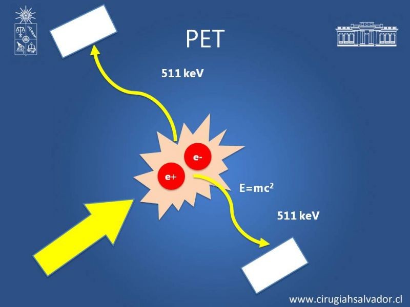 Diapositiva 4 de Utilidad de PET en cáncer de tiroides