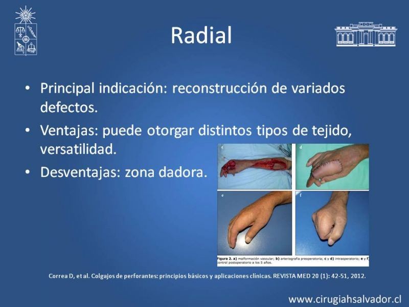 Diapositiva 17 de Colgajos Microquirúrgicos