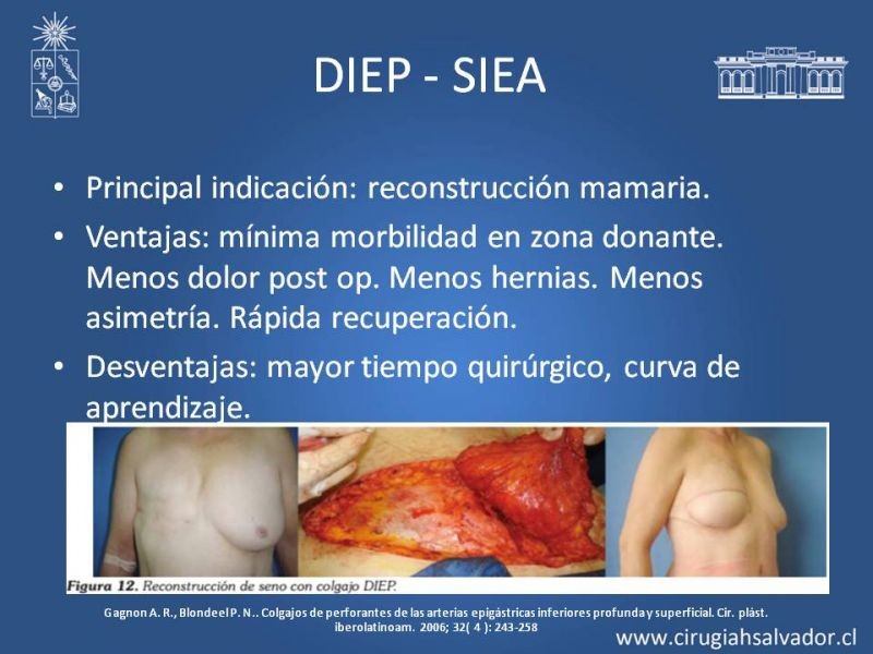 Diapositiva 14 de Colgajos Microquirúrgicos