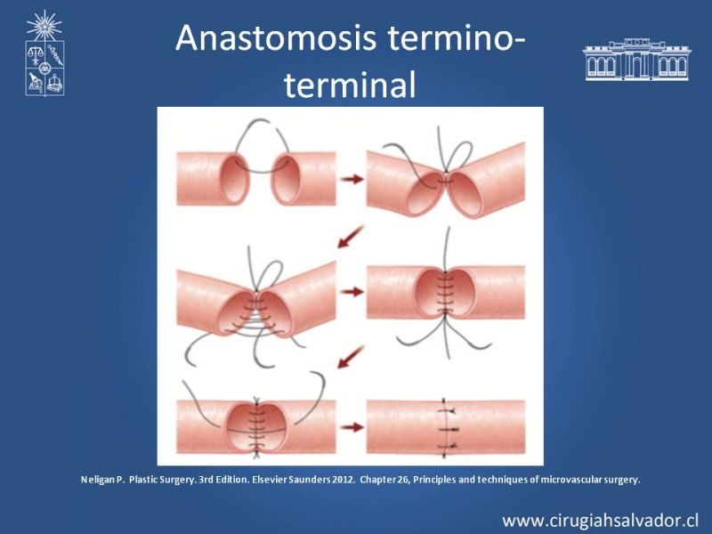 Diapositiva 20 de Principios Básicos de Microcirugía