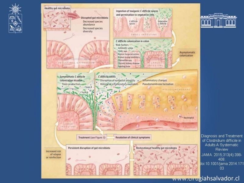 Diapositiva 4 de Diarrea por Clostridium Difficile