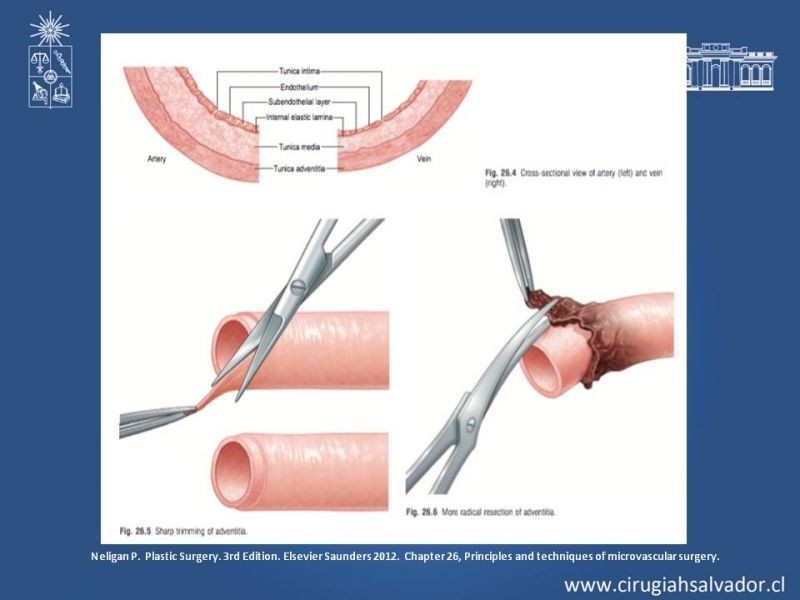 Diapositiva 14 de Principios Básicos de Microcirugía