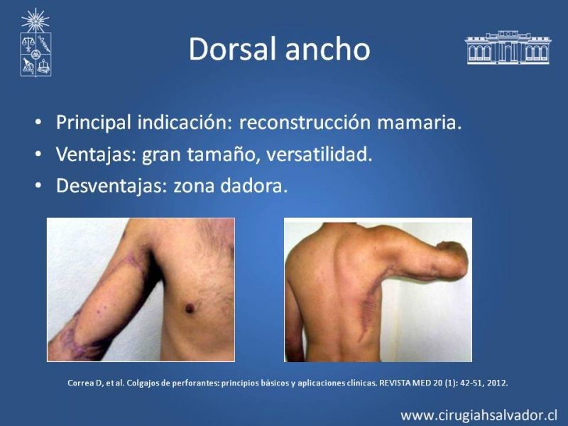 Diapositiva 16 de Colgajos Microquirúrgicos