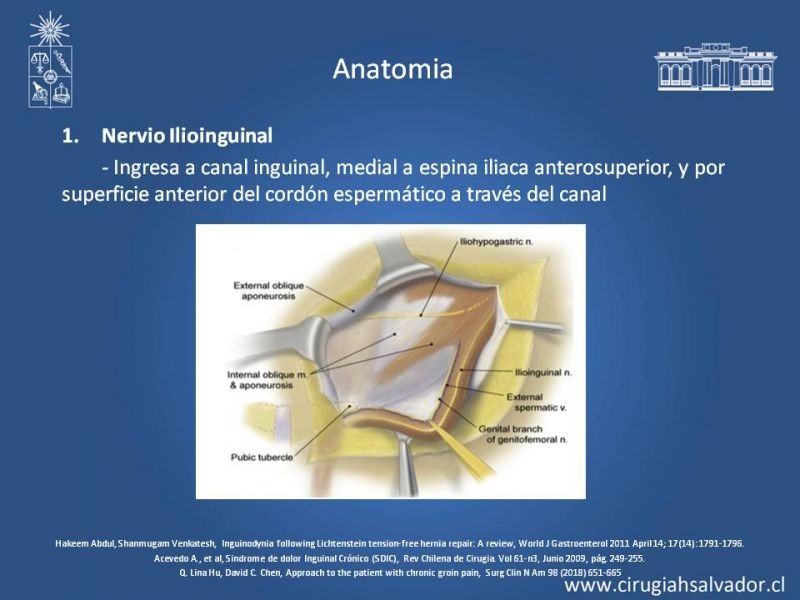 Diapositiva 12 de Manejo de Inguinodinia post Hernioplastía Inguinal