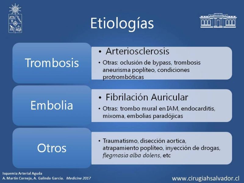 Diapositiva 5 de Isquemia Aguda de Extremidades Inferiores