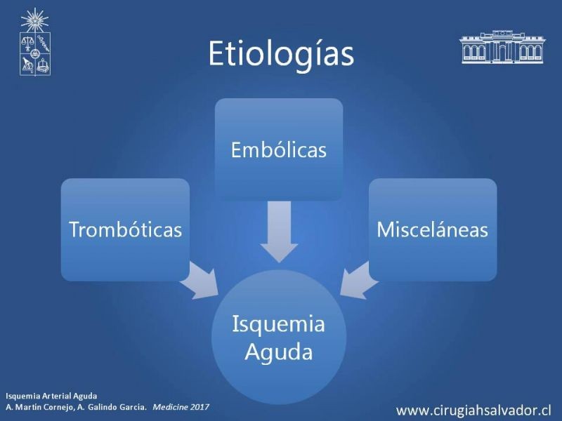 Diapositiva 4 de Isquemia Aguda de Extremidades Inferiores