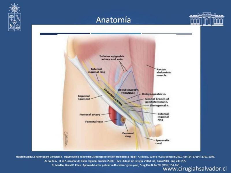 Diapositiva 11 de Manejo de Inguinodinia post Hernioplastía Inguinal