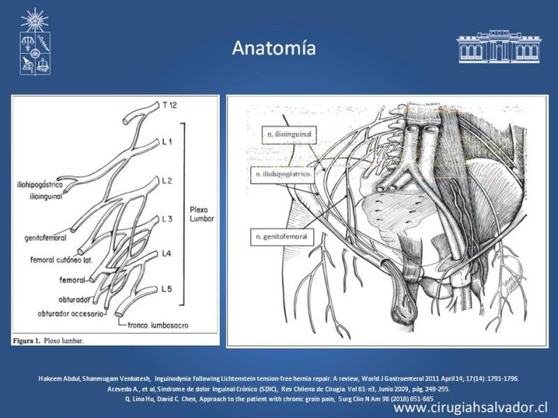 Diapositiva 16 de Manejo de Inguinodinia post Hernioplastía Inguinal