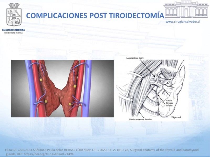 Diapositiva 7 de Hipocalcemia post Tiroidectomía