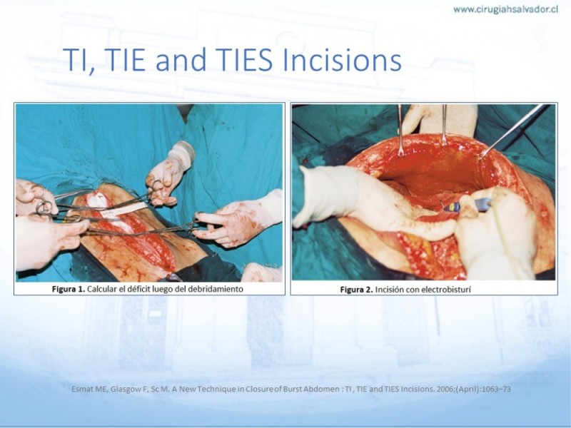 Diapositiva 39 de Manejo de la Evisceración