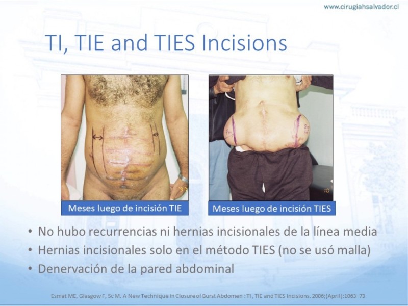 Diapositiva 41 de Manejo de la Evisceración