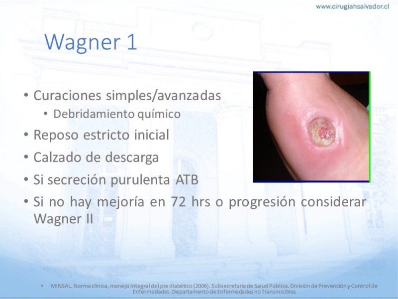 Diapositiva 25 de Manejo del Pie diabético