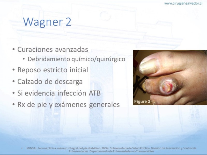 Diapositiva 26 de Manejo del Pie diabético