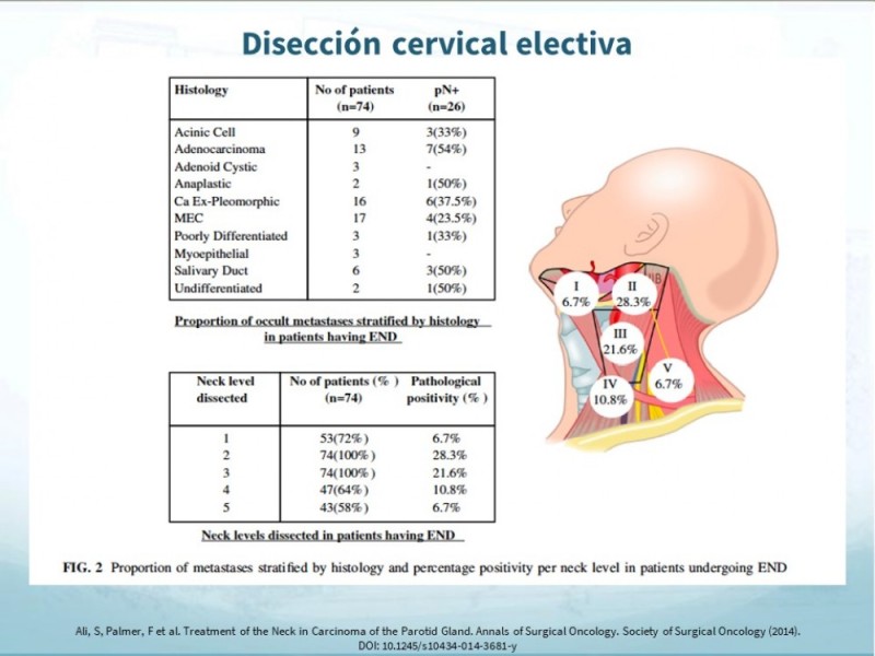 Diapositiva 31 de Tumores de Parótida