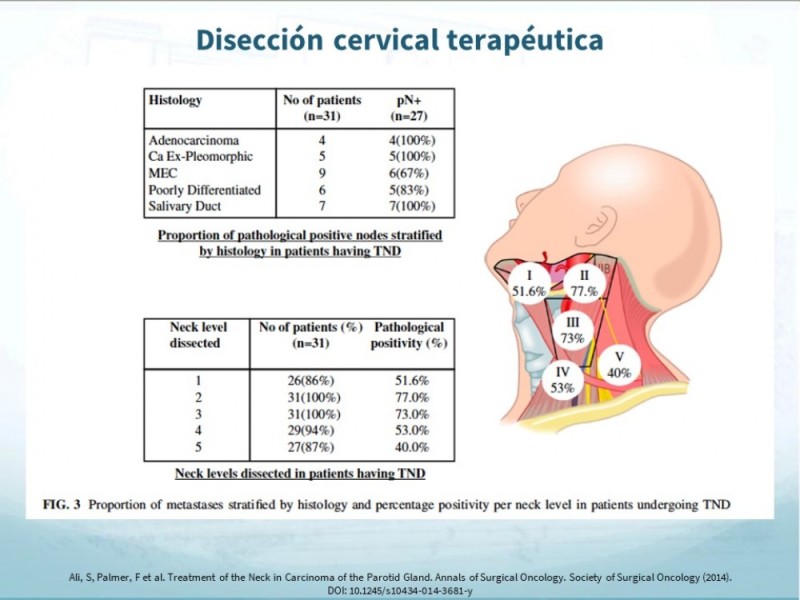 Diapositiva 32 de Tumores de Parótida