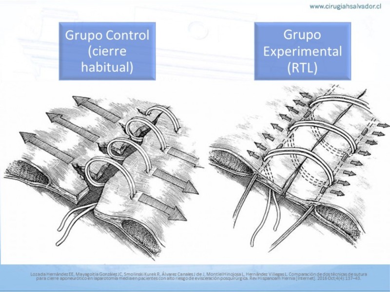 Diapositiva 35 de Manejo de la Evisceración