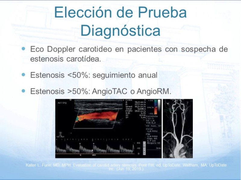 Diapositiva 25 de Estenosis Carotídea