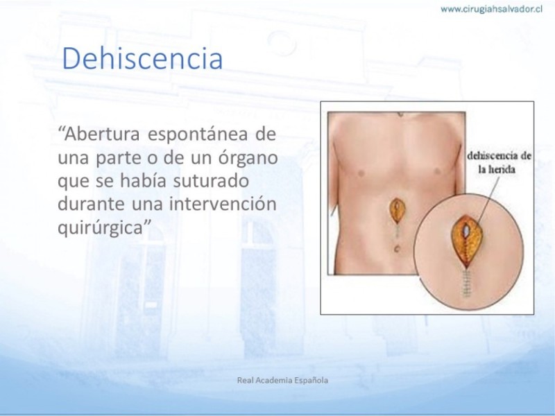 Diapositiva 4 de Manejo de la Evisceración