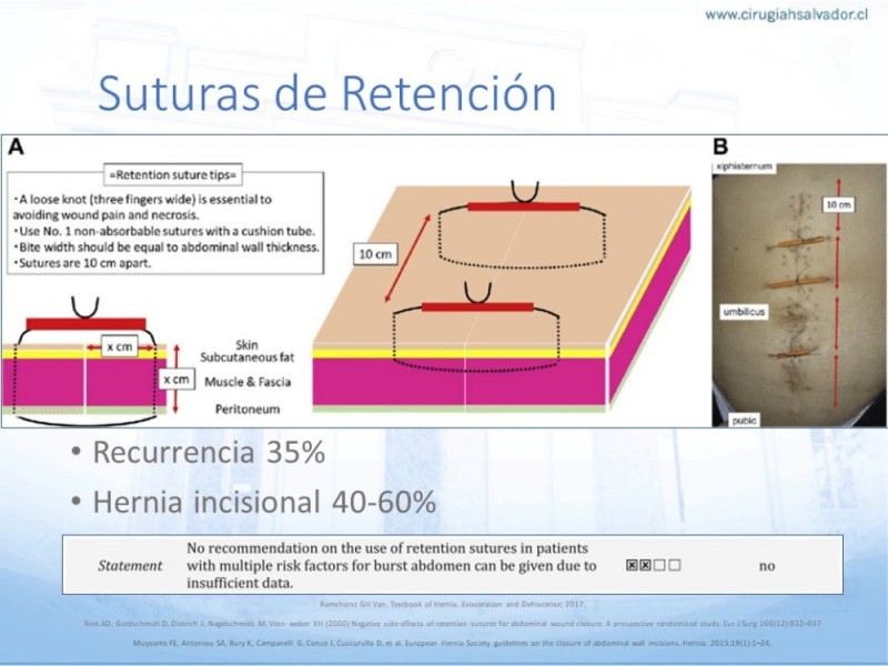 Diapositiva 32 de Manejo de la Evisceración