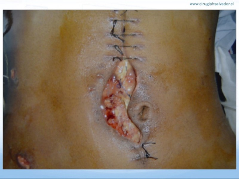Diapositiva 9 de Manejo de la Evisceración