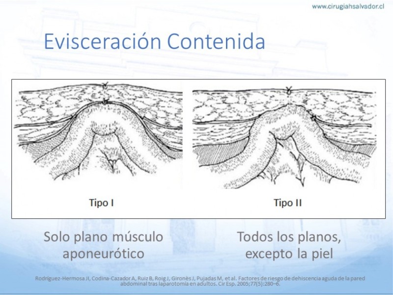 Diapositiva 7 de Manejo de la Evisceración