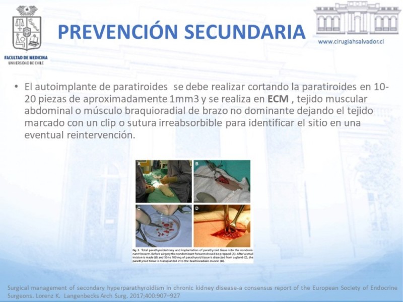 Diapositiva 20 de Hipocalcemia post Tiroidectomía