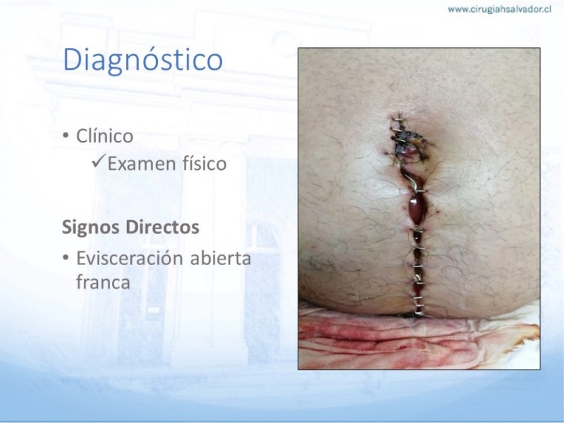 Diapositiva 19 de Manejo de la Evisceración