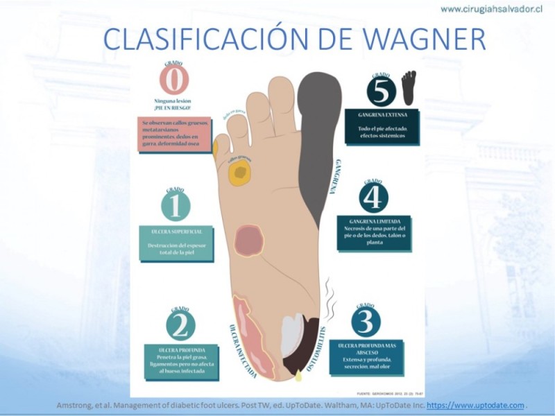 Diapositiva 14 de Manejo del Pie diabético