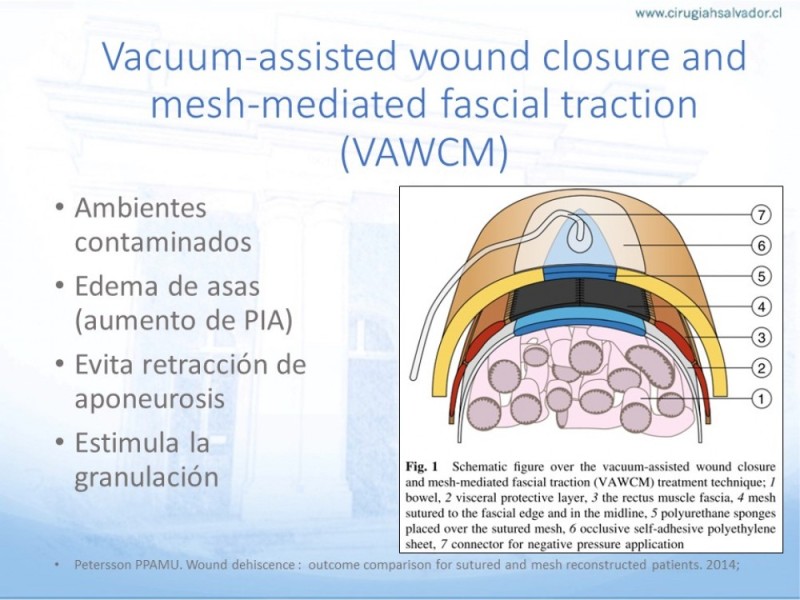 Diapositiva 47 de Manejo de la Evisceración