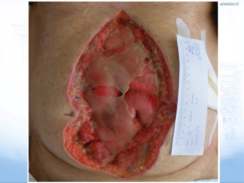Diapositiva 10 de Manejo de la Evisceración