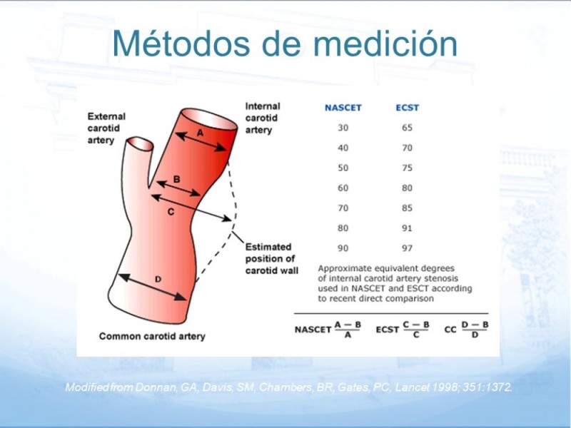 Diapositiva 13 de Estenosis Carotídea