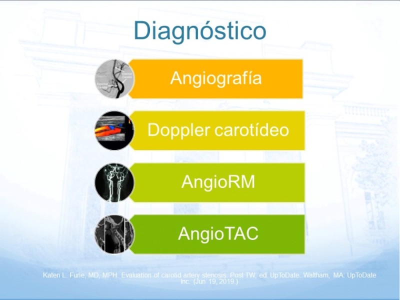 Diapositiva 12 de Estenosis Carotídea