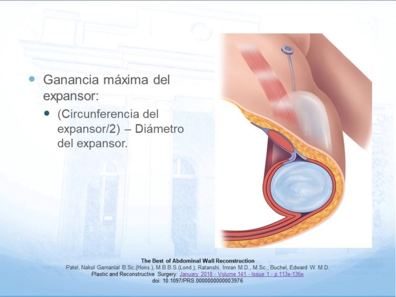 Diapositiva 18 de Reconstrucción de Pared Abominal