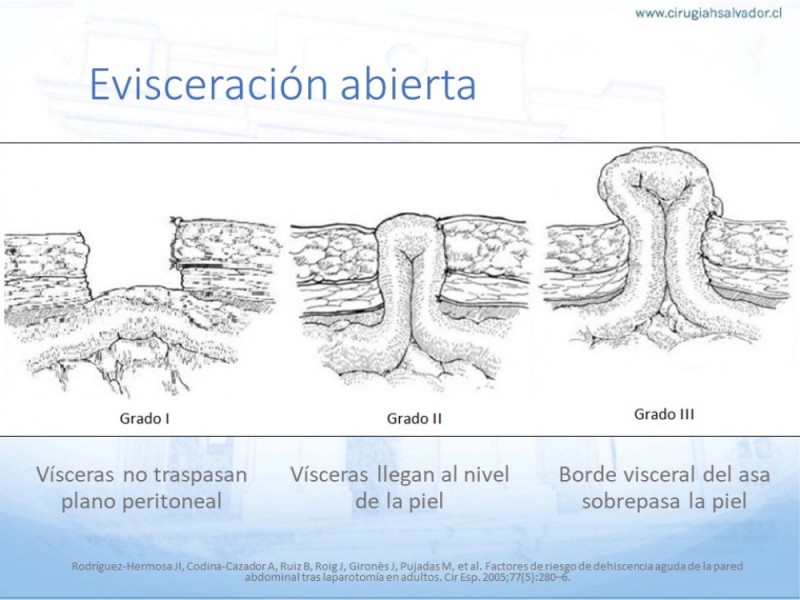 Diapositiva 8 de Manejo de la Evisceración
