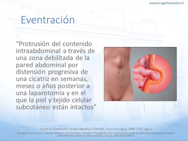 Diapositiva 5 de Manejo de la Evisceración