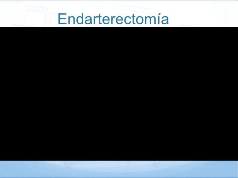 Diapositiva 34 de Estenosis Carotídea