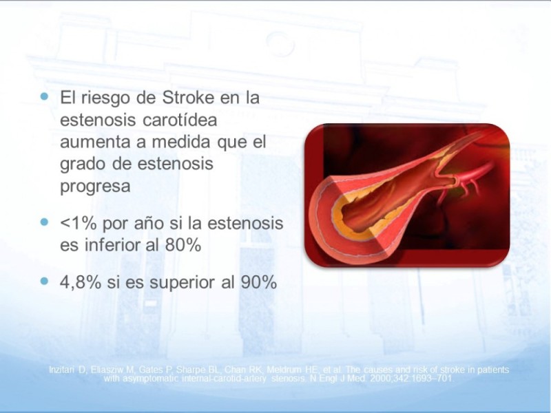 Diapositiva 7 de Estenosis Carotídea