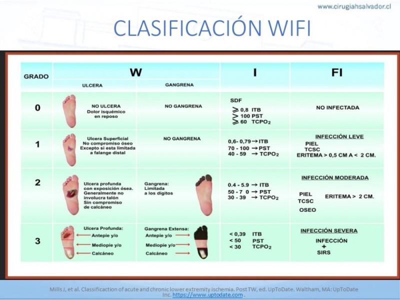Diapositiva 15 de Manejo del Pie diabético