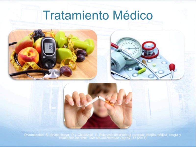 Diapositiva 30 de Estenosis Carotídea